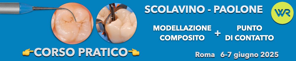 MODELLAZIONE POSTERIORI DIRETTI