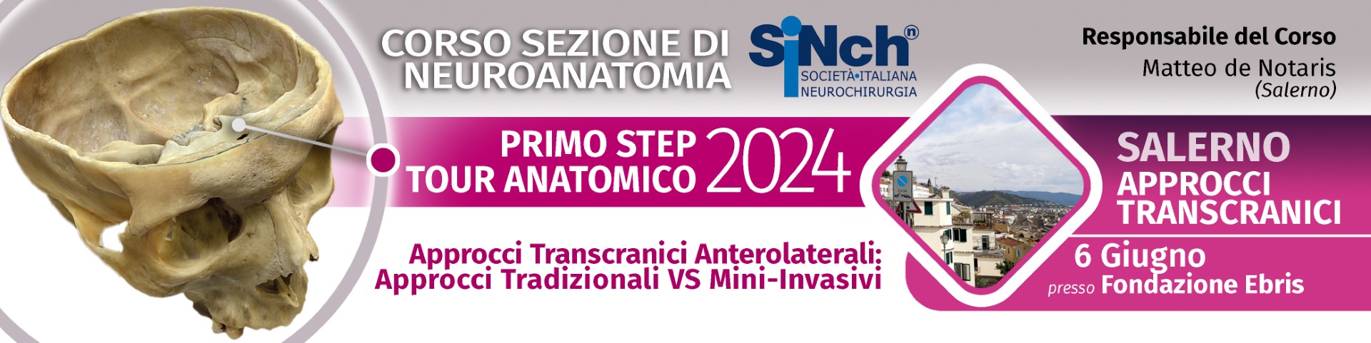 APPROCCI TRANSCRANICI ANTEROLATERALI:  APPROCCI TRADIZIONALI VS MINI-INVASIVI