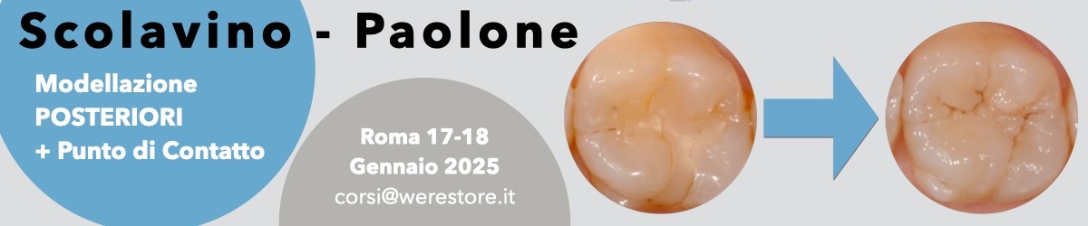 MODELLAZIONE POSTERIORI DIRETTI