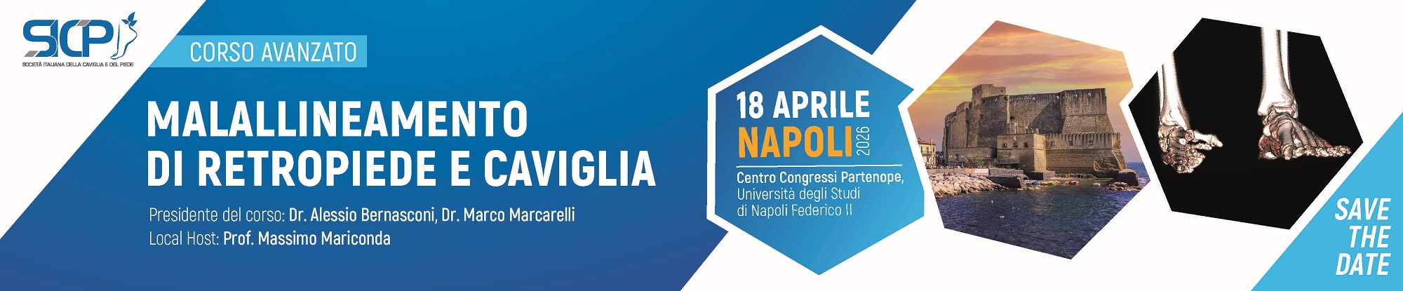 Corso Avanzato SICP Malallineamento di retropiede e caviglia, Napoli 18 aprile 2026