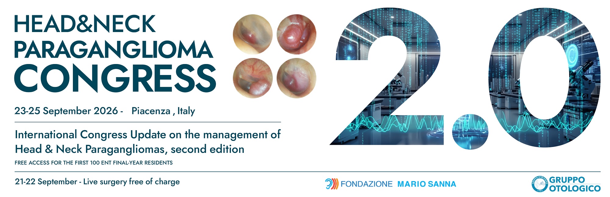 2nd International Congress - Update on the Management of Head and Neck Paragangliomas